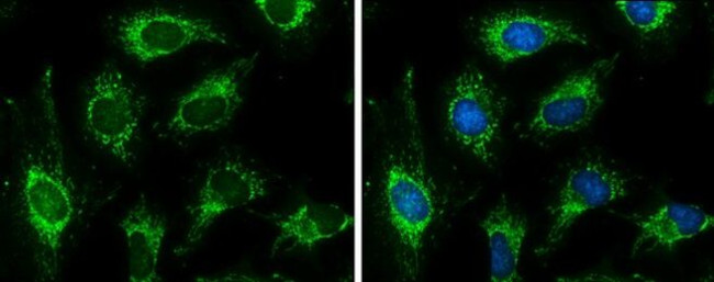 PDHB Antibody in Immunocytochemistry (ICC/IF)