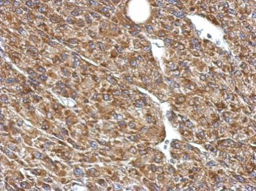 PDHB Antibody in Immunohistochemistry (Paraffin) (IHC (P))