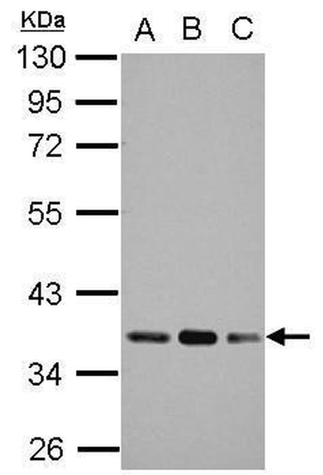 PDHB Antibody in Western Blot (WB)