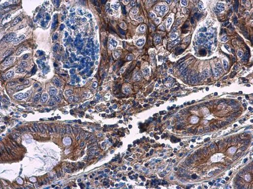 CHST4 Antibody in Immunohistochemistry (Paraffin) (IHC (P))