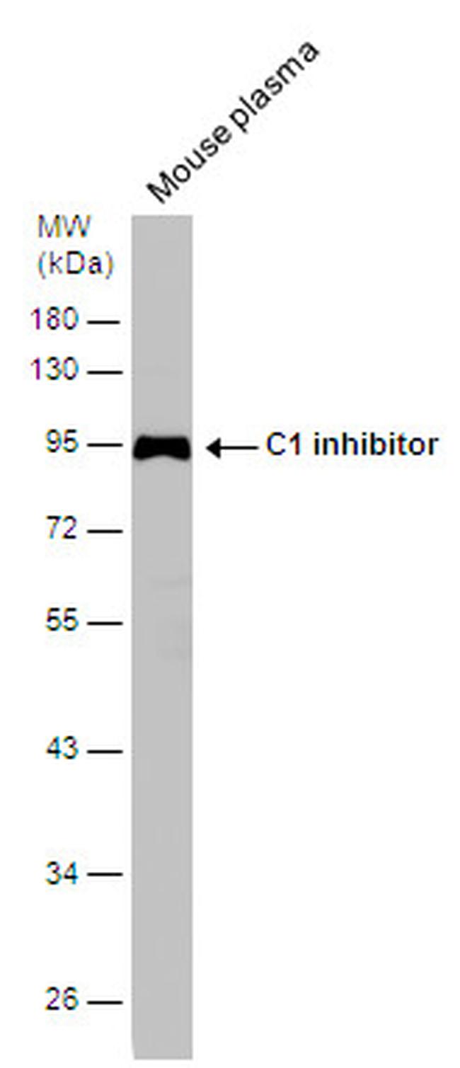 C1 inhibitor Antibody in Western Blot (WB)