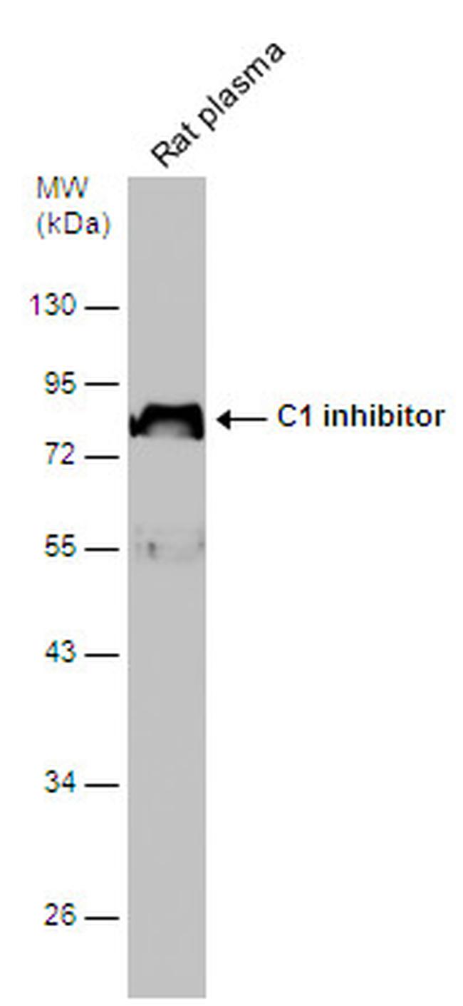 C1 inhibitor Antibody in Western Blot (WB)