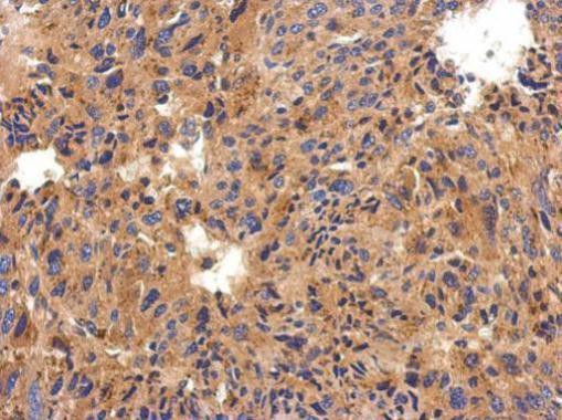 C1 inhibitor Antibody in Immunohistochemistry (Paraffin) (IHC (P))