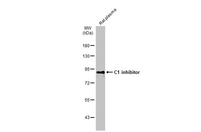 C1 inhibitor Antibody in Western Blot (WB)