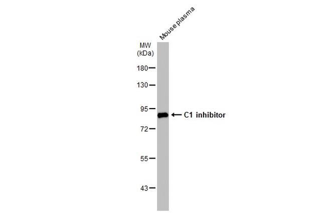 C1 inhibitor Antibody in Western Blot (WB)