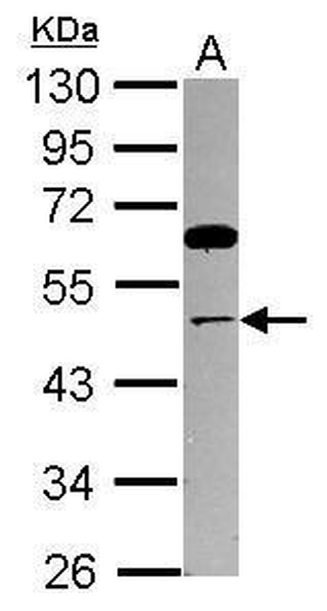 TRIP13 Antibody in Western Blot (WB)