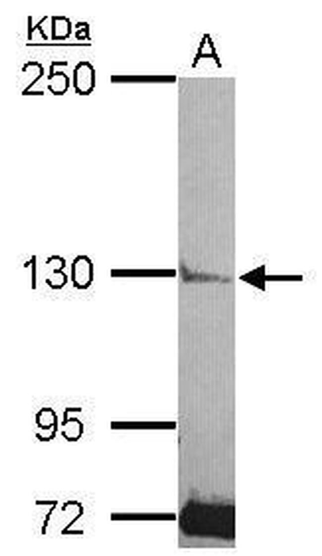 PLCL2 Antibody in Western Blot (WB)