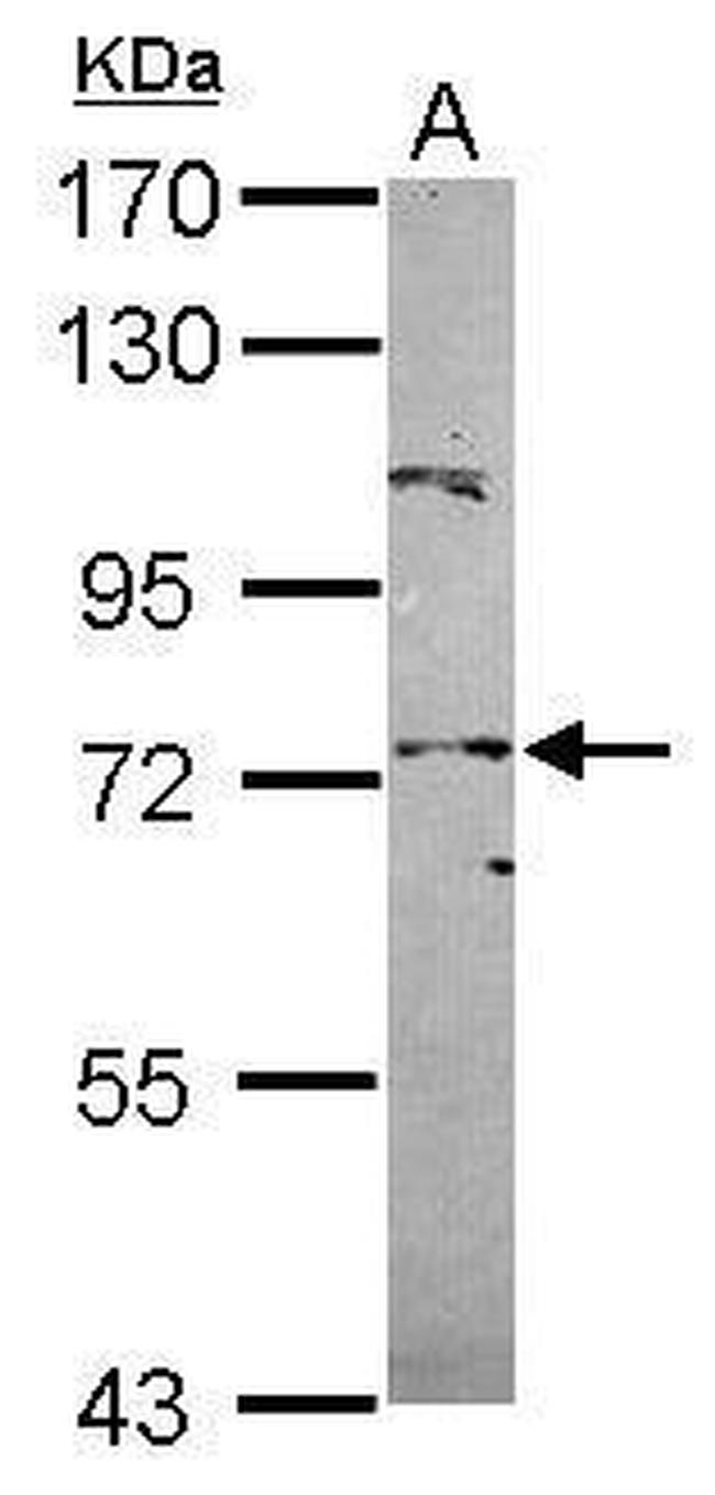 POT1 Antibody in Western Blot (WB)