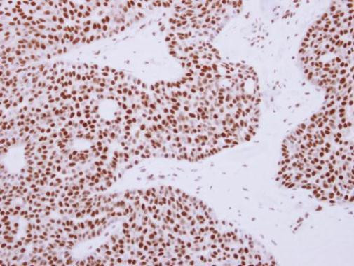 RAD50 Antibody in Immunohistochemistry (Paraffin) (IHC (P))