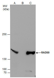 RAD50 Antibody in Immunoprecipitation (IP)