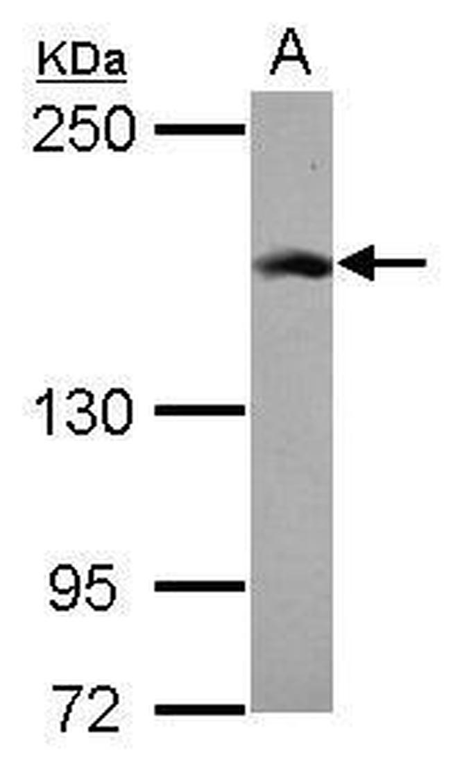 RAD50 Antibody in Western Blot (WB)