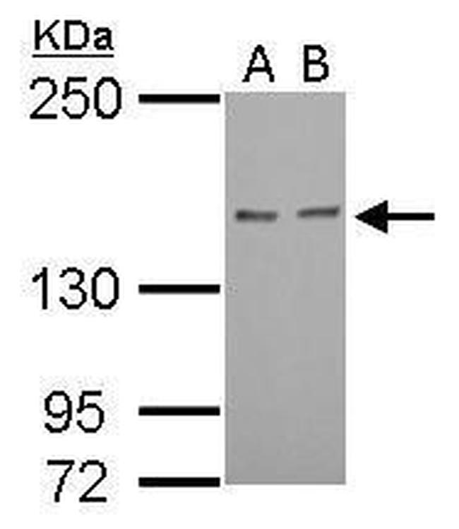 RAD50 Antibody in Western Blot (WB)