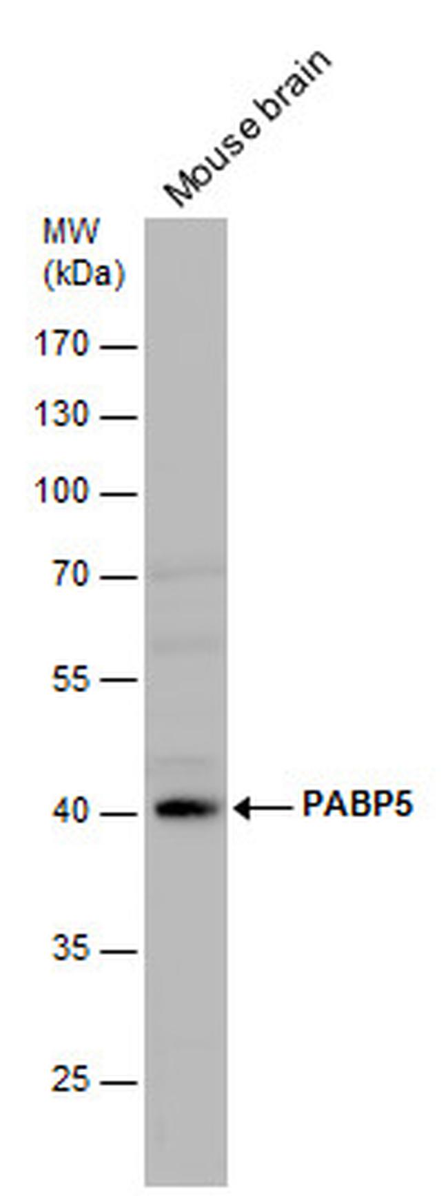 PABPC5 Antibody in Western Blot (WB)