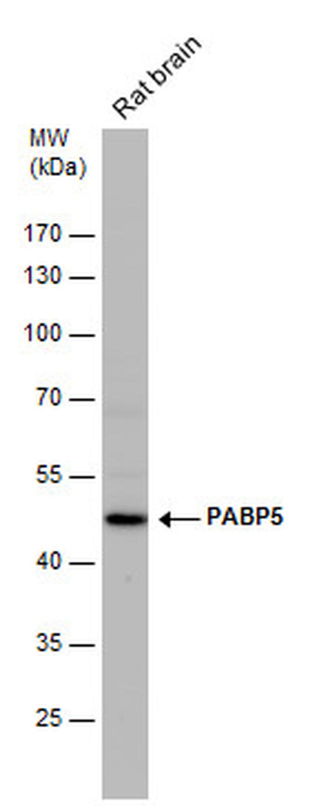 PABPC5 Antibody in Western Blot (WB)