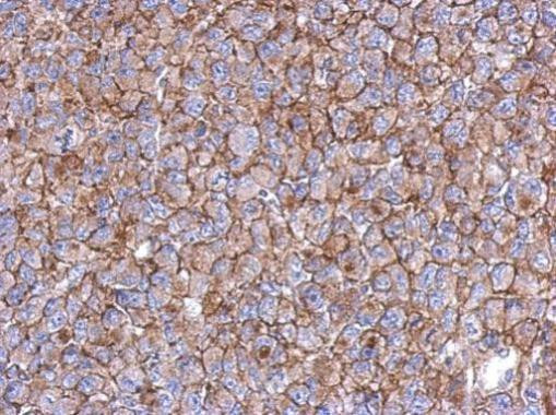 KIAA0090 Antibody in Immunohistochemistry (Paraffin) (IHC (P))