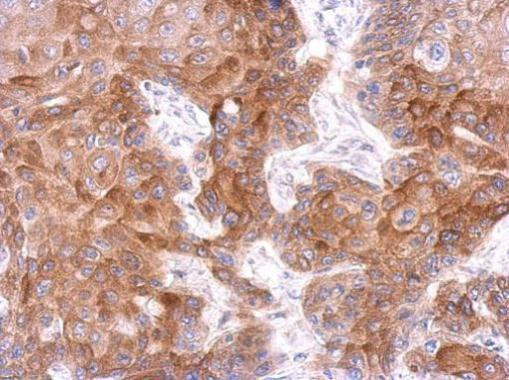 FCHO1 Antibody in Immunohistochemistry (Paraffin) (IHC (P))