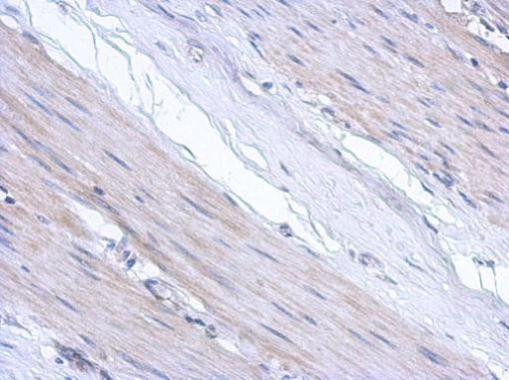 ABCF3 Antibody in Immunohistochemistry (Paraffin) (IHC (P))