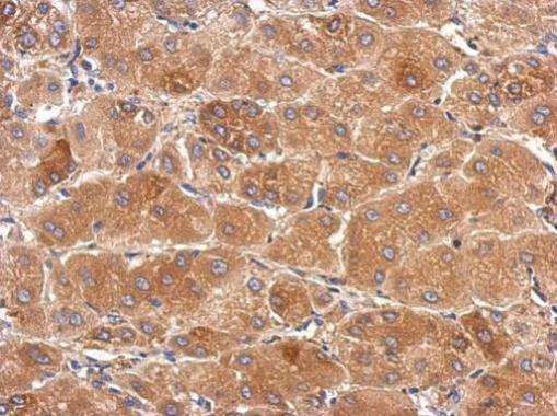 SLC25A36 Antibody in Immunohistochemistry (Paraffin) (IHC (P))