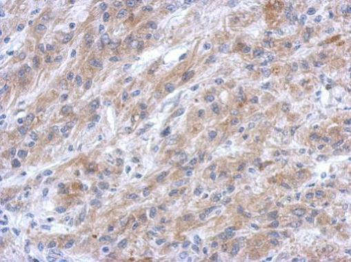 EFHC2 Antibody in Immunohistochemistry (Paraffin) (IHC (P))