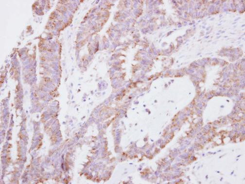 EAP30 Antibody in Immunohistochemistry (Paraffin) (IHC (P))