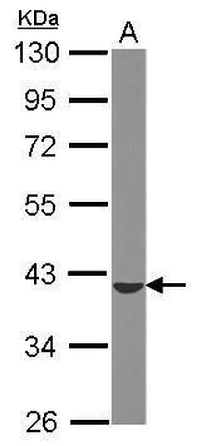 ST6GALNAC4 Antibody in Western Blot (WB)