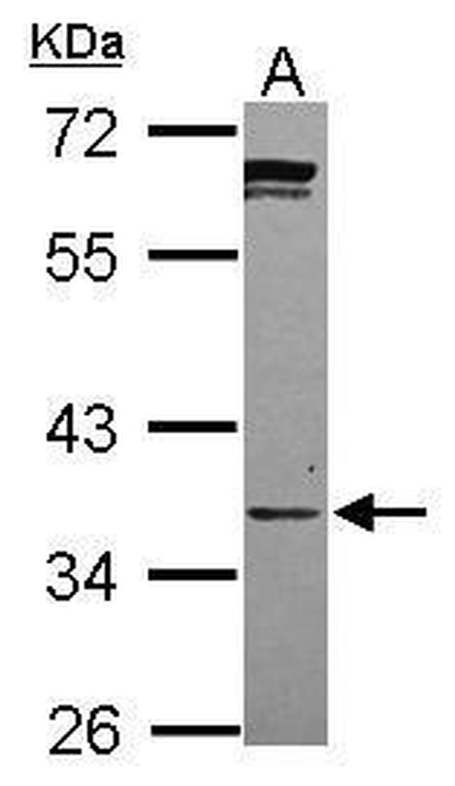 PPCS Antibody in Western Blot (WB)