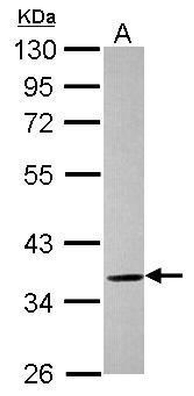 ELMOD1 Antibody in Western Blot (WB)