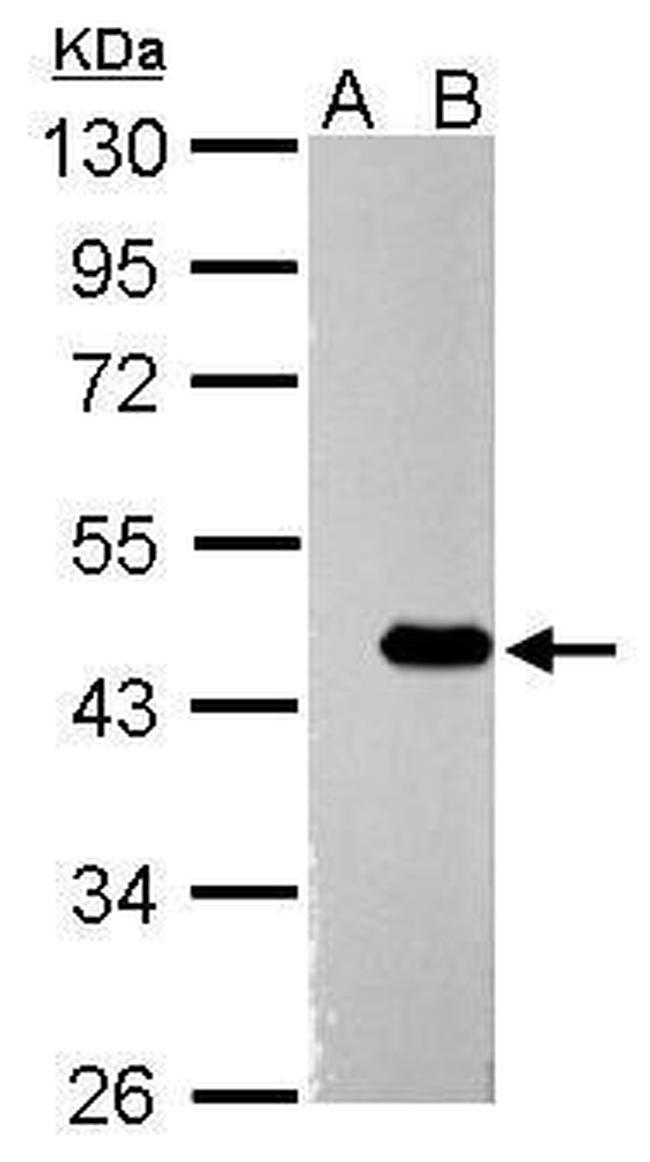 ZBTB24 Antibody in Western Blot (WB)