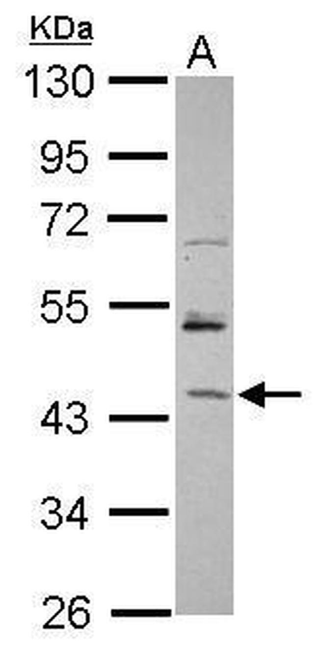 RBM17 Antibody in Western Blot (WB)