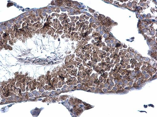 KATNAL1 Antibody in Immunohistochemistry (Paraffin) (IHC (P))