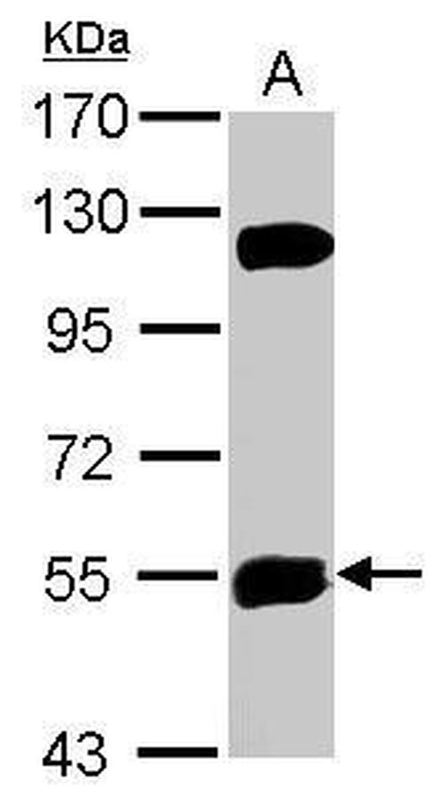 KATNAL1 Antibody in Western Blot (WB)