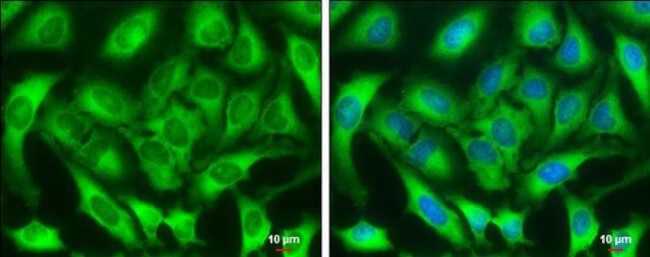 ZC3HAV1 Antibody in Immunocytochemistry (ICC/IF)