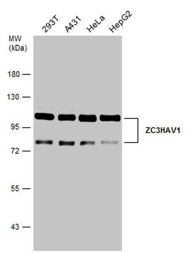 ZC3HAV1 Antibody in Western Blot (WB)