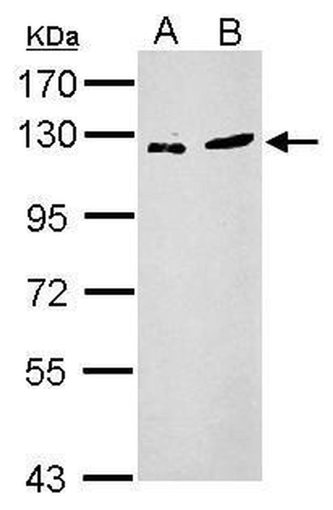 ZNF711 Antibody in Western Blot (WB)