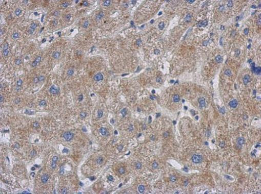 GCC1 Antibody in Immunohistochemistry (Paraffin) (IHC (P))