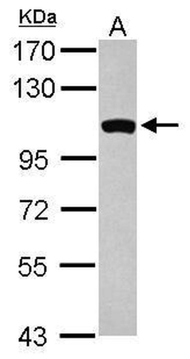 GCC1 Antibody in Western Blot (WB)