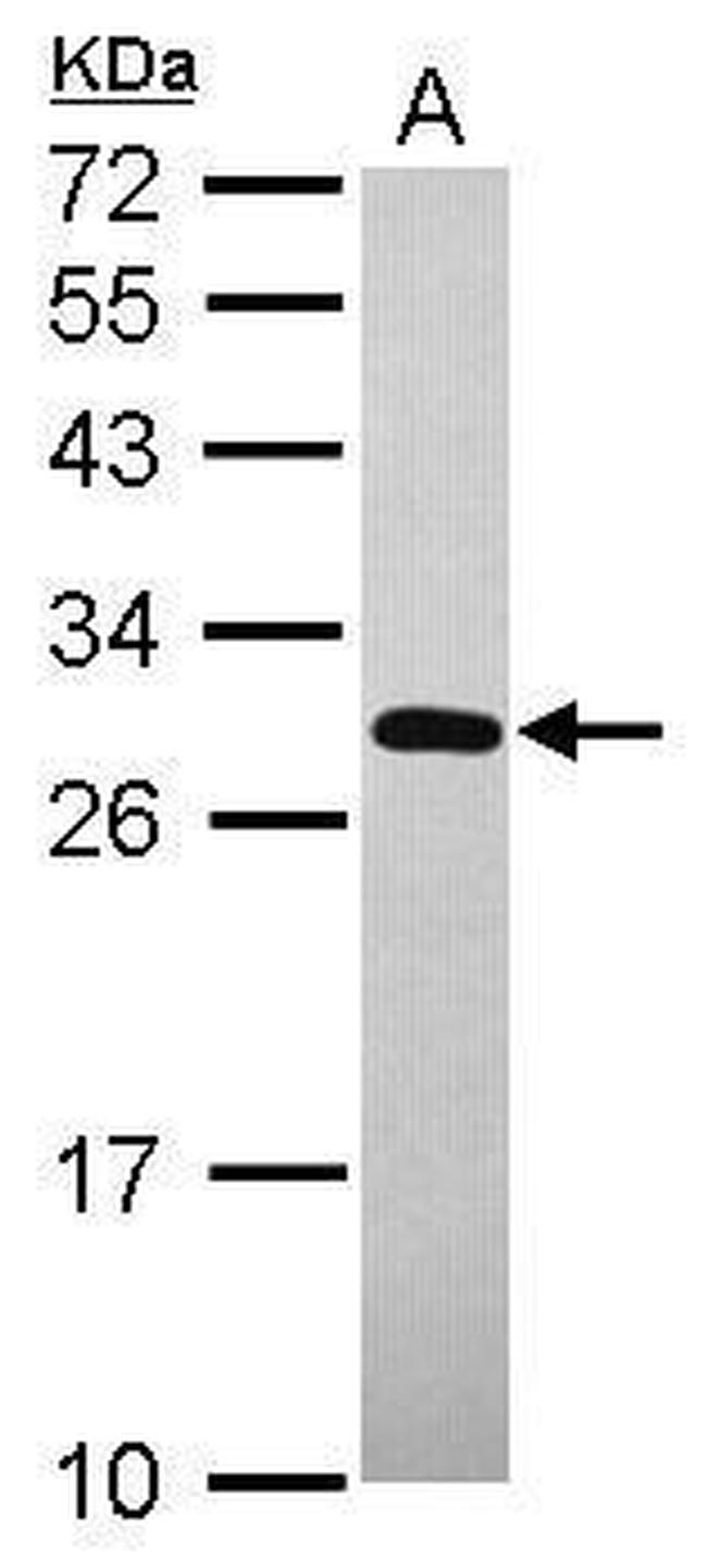 UNKL Antibody in Western Blot (WB)