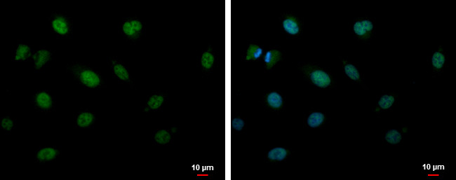 CIRBP Antibody in Immunocytochemistry (ICC/IF)