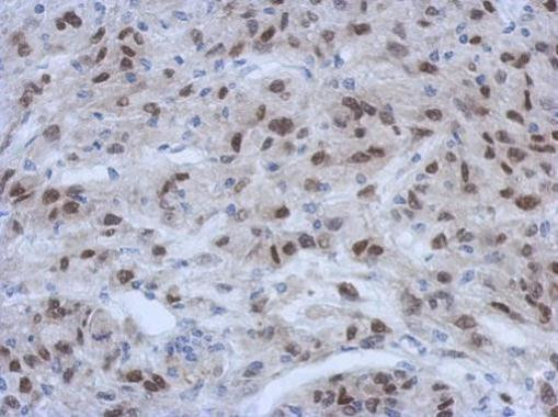 CIRBP Antibody in Immunohistochemistry (Paraffin) (IHC (P))