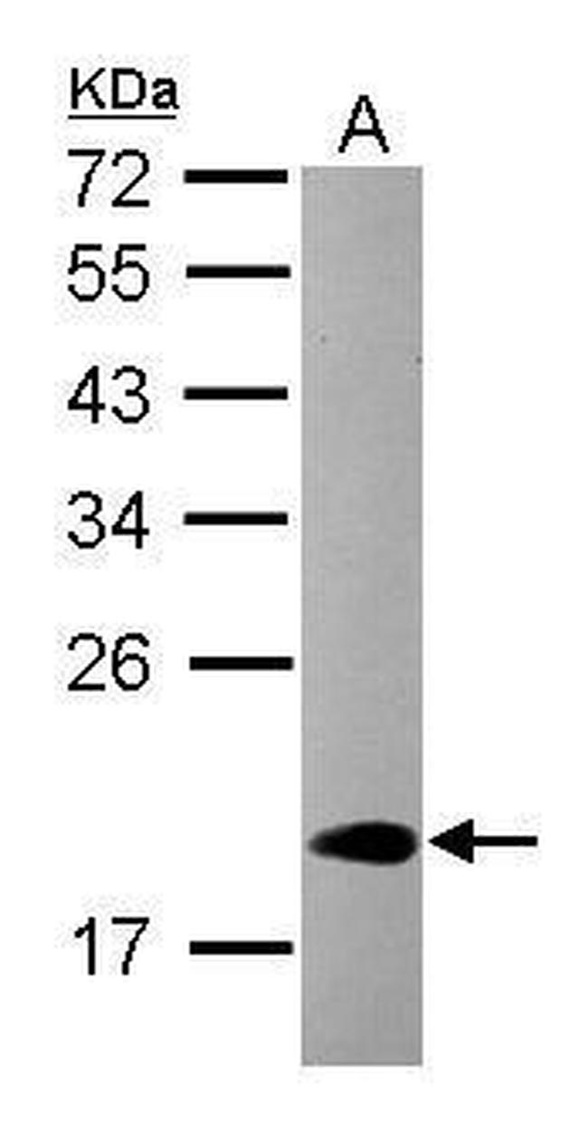 CIRBP Antibody in Western Blot (WB)