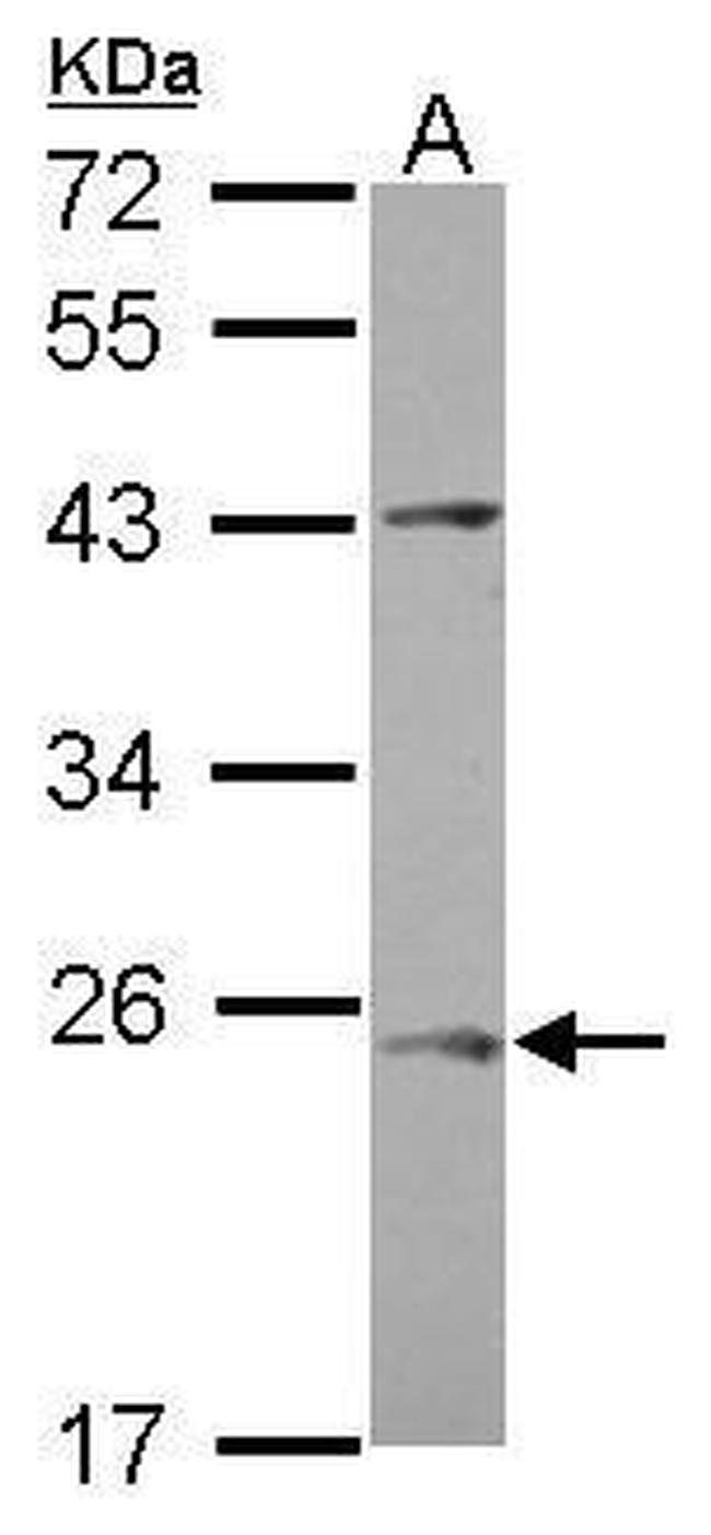 C1orf146 Antibody in Western Blot (WB)