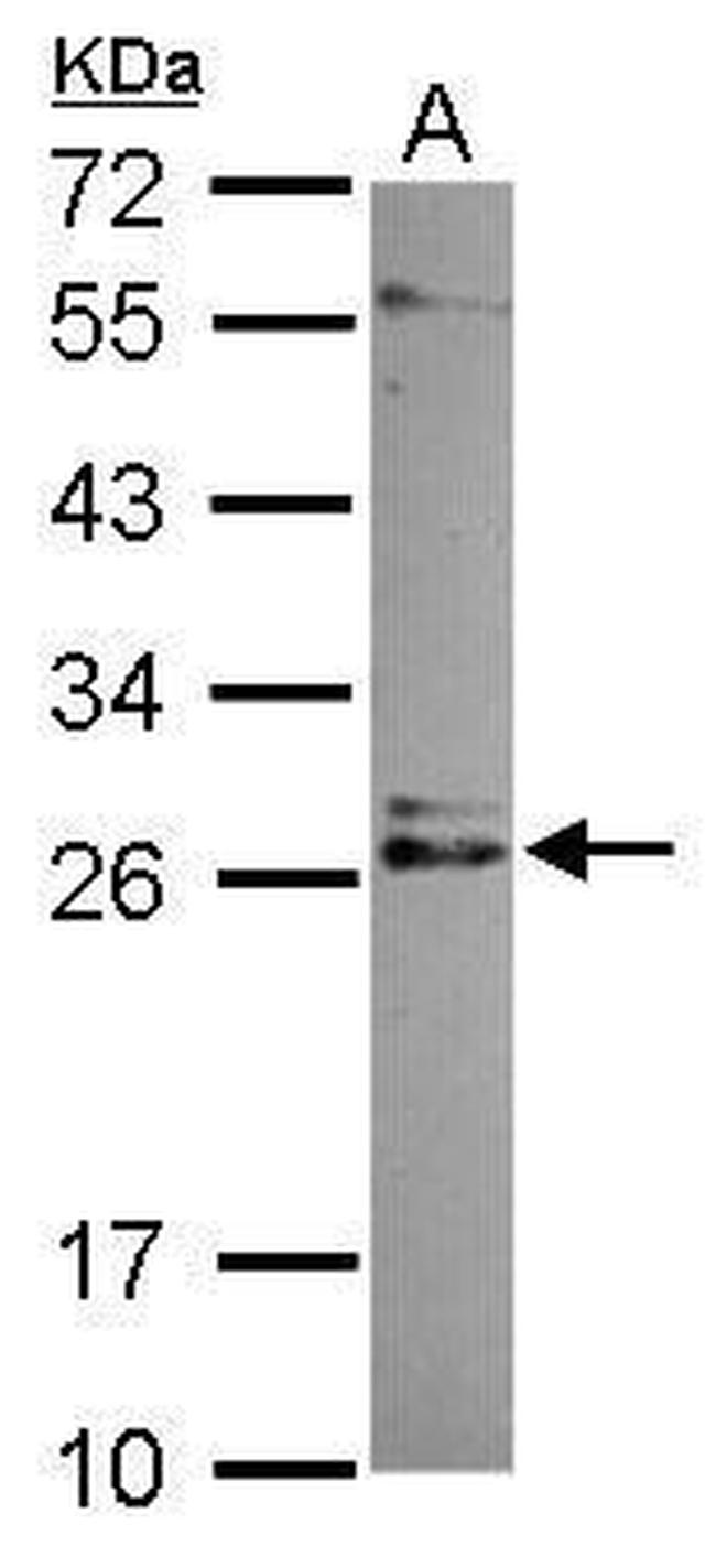 IMP3 Antibody in Western Blot (WB)