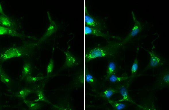 RAB35 Antibody in Immunocytochemistry (ICC/IF)