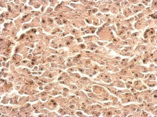 Nop25 Antibody in Immunohistochemistry (Paraffin) (IHC (P))