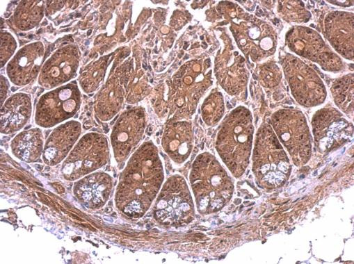 Nop25 Antibody in Immunohistochemistry (Paraffin) (IHC (P))