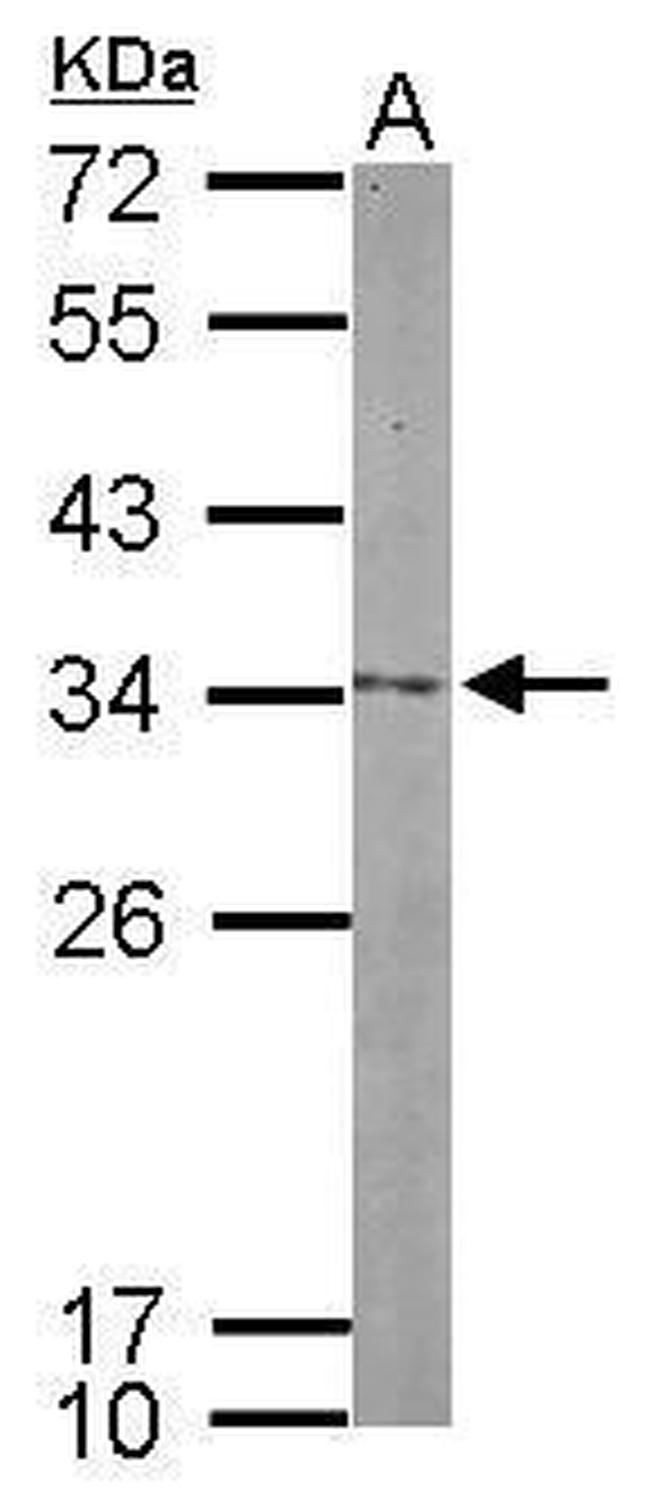 Nop25 Antibody in Western Blot (WB)