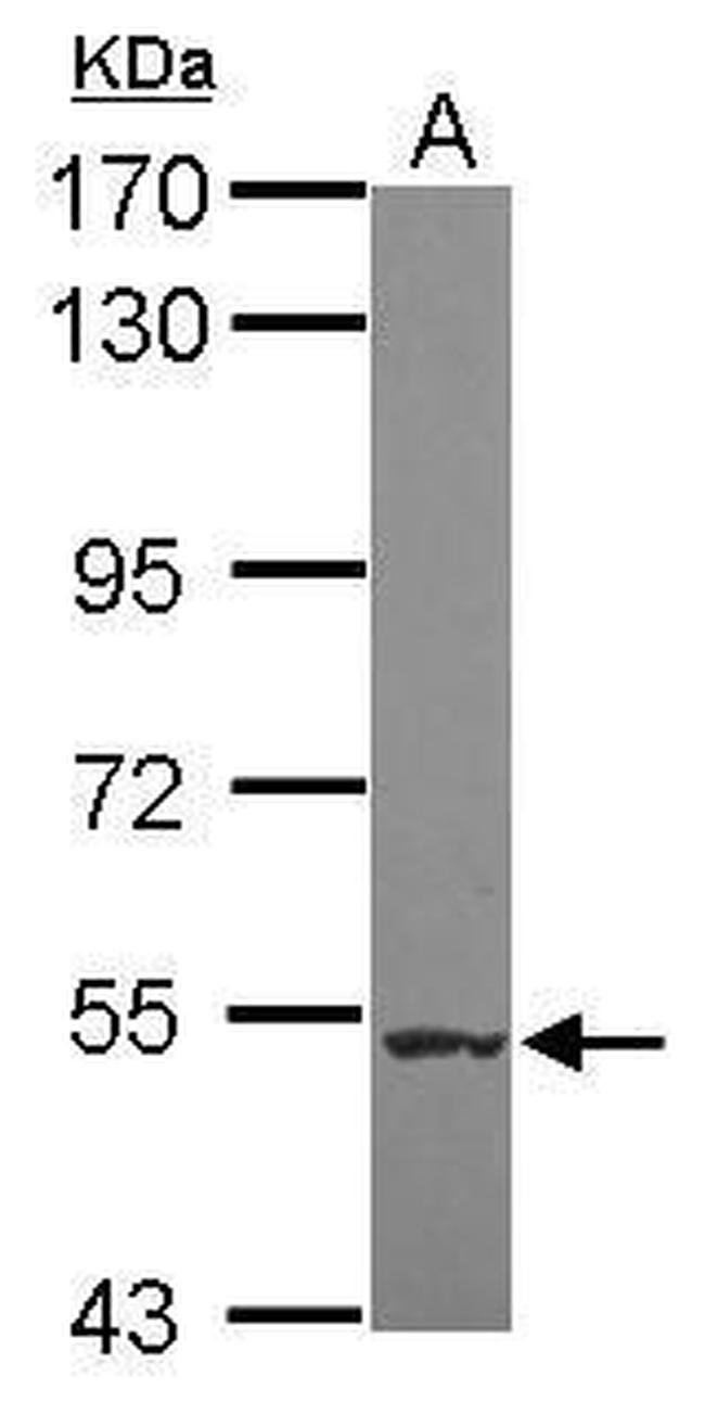 NAA16 Antibody in Western Blot (WB)