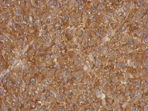 ACTRT1 Antibody in Immunohistochemistry (Paraffin) (IHC (P))