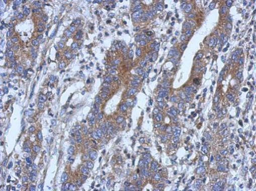 NSUN4 Antibody in Immunohistochemistry (Paraffin) (IHC (P))