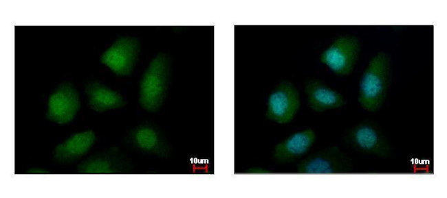 PELO Antibody in Immunocytochemistry (ICC/IF)